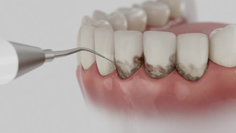 Reliable Emergency Dentist contractor in Dover, OH by Smile Center Dentistry